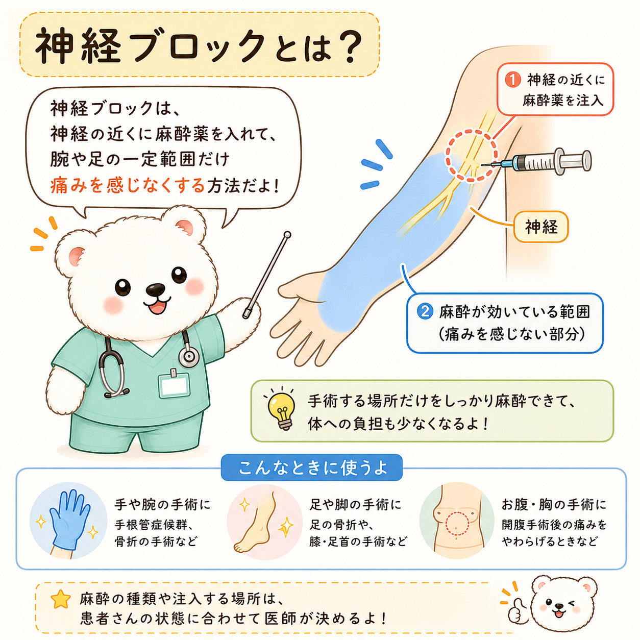 神経の近くに麻酔薬を入れ、腕や足の一定範囲に麻酔を効かせる神経ブロックのイラスト